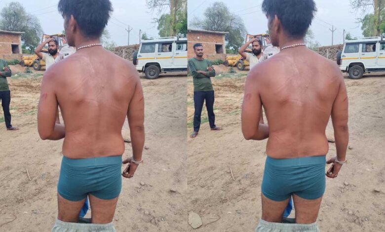 रेत-खदान-बलबहरा-के-कर्मचारियों-से-मारपीट-का-मामला-प्रकाश-में-आया